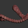 3D Medical Illustration of Human Intestinal Anatomy Model with Red Inflamed Areas