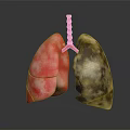 3D Lung Anatomy Model Medical Device For Medical Education Detailed Structure