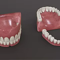 Dental Medical Devices Featuring Red Denture Bases And White Teeth Components 3d model