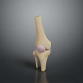 Knee Joint Medical Device 3D Model for Orthopedic Implant and Surgical Planning