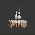3D Model Of Oral Dental Medical Device Implant Abutment With Prosthetic Teeth