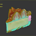 Delicious Strawberry Cheesecake With Fresh Strawberry Topping Whipped Cream Creamy Yellow Layer And Crust
