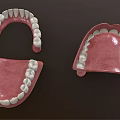 Dental Medical Devices Featuring Red Denture Bases And White Teeth Components 3d model