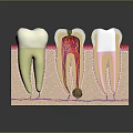 Animated Game Character Dental Anatomy Display With Healthy Decayed And Treated Teeth