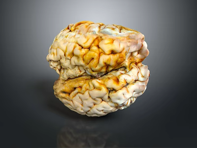 Anatomical Human Brain Model Medical Device Featuring Detailed Neural Structure And Texture 3d model