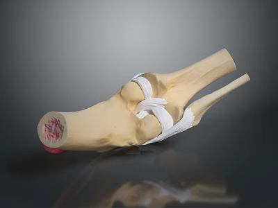 Detailed Joint Anatomical Medical Device Model With Bones Ligaments And Soft Tissues 3d model