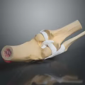 Detailed Joint Anatomical Medical Device Model With Bones Ligaments And Soft Tissues