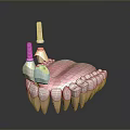 3D Model Of Oral Dental Medical Device Implant Abutment With Prosthetic Teeth