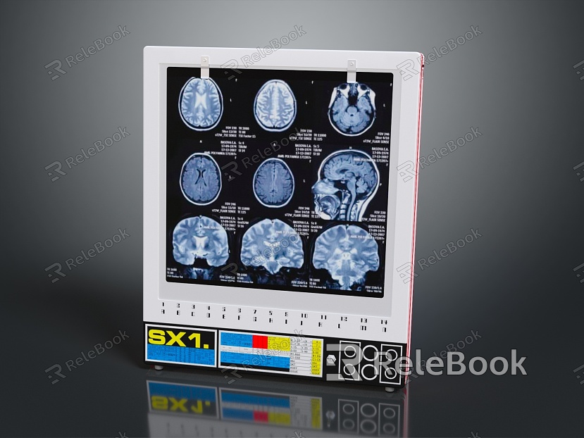 Modern X-ray Machine Optical Machine Medical Display Carik Optical Machine Medical Equipment model