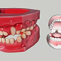 Dental Model Ornament Decorative Figurine Set With Red Pink Tooth Structure And Small Figurines Inside