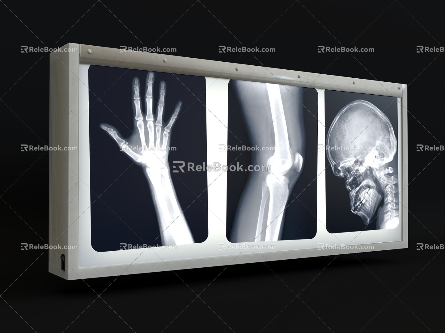 Film viewing light X-ray film viewing light box film reading light box film viewing light box X-ray film film viewing light radiation film image light box medical equipment medical equipment 3d model