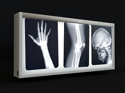 Film viewing light X-ray film viewing light box film reading light box film viewing light box X-ray film viewing light radiation film image light box medical equipment medical equipment 3d model