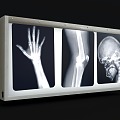 Film viewing light X-ray film viewing light box film reading light box film viewing light box X-ray film film viewing light radiation film image light box medical equipment medical equipment 3d model