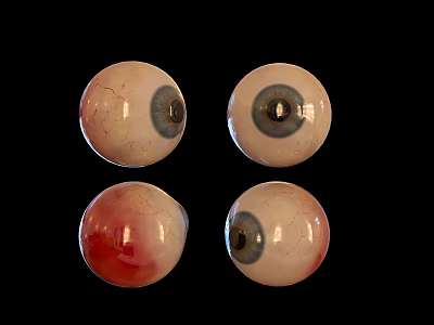 Four Realistic Human Eyeballs With Cracked Surfaces And Bloodshot Details 3d model