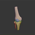 Knee Joint Medical Device 3D Model for Orthopedic Implant and Surgical Planning