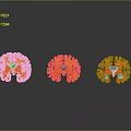 head structure head planer face human head planer face human brain planer face head structure brain structure human head structure 3d model