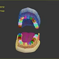 Human Teeth Dental Model Displaying Upper And Lower Jaw White Teeth Pink Gums