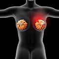 Medical Device for Breast Examination Visualizing Highlighted Area on Human Body Model