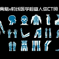 Human Body Skeleton X Ray Medical Examination CT Image Wall Hanging