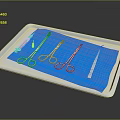 Sterile Medical Instruments Organized on Metal Tray with Blue Cloth and Surgical Tools