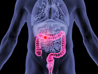 Advanced Medical Device for 3D Visualization of Human Digestive System Intestine Highlighted Lesion Detection 3d model