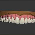 Dental Teeth Model With Pink Gums White Teeth And Orange Orthodontic Tray