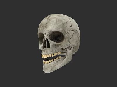 Human Skull With Grayish White Surface Cracks And Visible Teeth On Dark Background 3d model