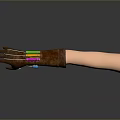 Brown Prosthetic Arm Device With Pink Blue Components And Light Colored Arm Model