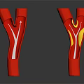 Tissue System with Y Shaped Red Branches Showing White and Yellow Flow Structures