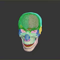 Medical Anatomical Skull Model With Transparent Brain Structure For Human Anatomy Teaching