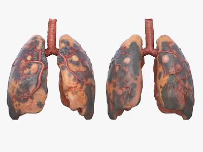 Detailed View Of Lung Tissue System Anatomical Structure And Functions 3d model
