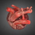 3D Heart Model Medical Device for Anatomical Education and Surgical Planning