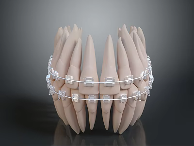 Dental Teeth Model Displaying Clear Orthodontic Braces For Teeth Alignment 3d model