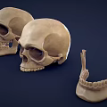 Anatomical Display Of Two Human Skulls With Mandible And Skeleton Parts
