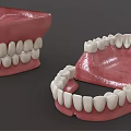 Dental Medical Devices Featuring Red Denture Bases And White Teeth Components 3d model