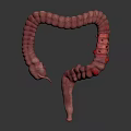3D Medical Illustration of Human Intestinal Anatomy Model with Red Inflamed Areas