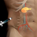Medical Device Syringe for Human Abdominal Anatomy Visualization with Internal Organs and Blood Vessels