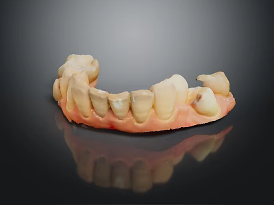 Dental Teeth Model With White Restored Teeth And Pink Gum Base For Dental Study 3d model