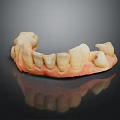 Dental Teeth Model With White Restored Teeth And Pink Gum Base For Dental Study