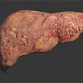 Realistic Human Liver Organ Anatomy Model With Detailed Texture And Pinkish Appearance