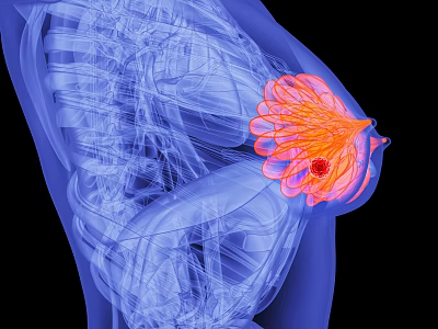Medical Imaging Device for Breast Internal Structure and Lesion Detection 3d model