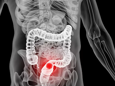 Advanced Medical Device for Human Digestive System Intestine Examination and Anomaly Detection 3d model