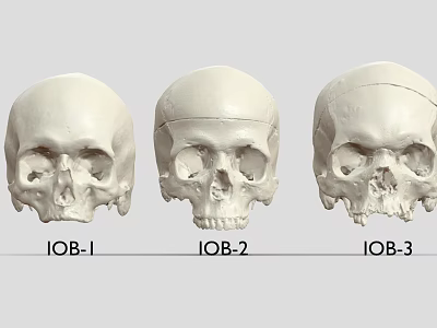 Professional Medical Skull Models With IOB 1 IOB 2 IOB 3 For Anatomical Training 3d model