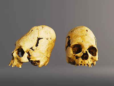 Two Human Skulls Showing Lateral And Frontal Views With Yellowish Cracks And Spots 3d model