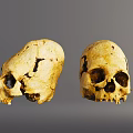 Two Human Skulls Showing Lateral And Frontal Views With Yellowish Cracks And Spots