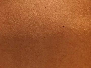 Skin texture (ID:ffabg52157)