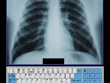 X-ray texture (ID:ffacg38707)