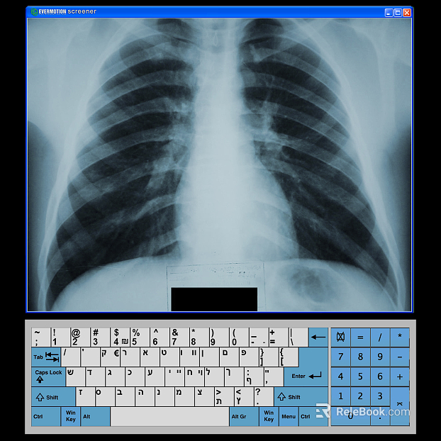 X-ray texture