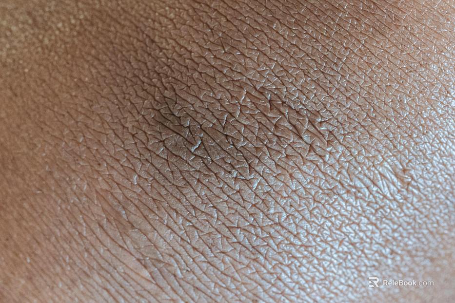 Skin texture