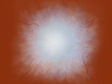 Red-brown eye vascular texture map (ID:ffaeh396866)